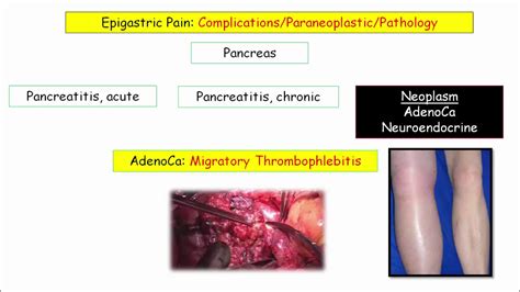 Epigastric Pain Symptoms Causes Treatment