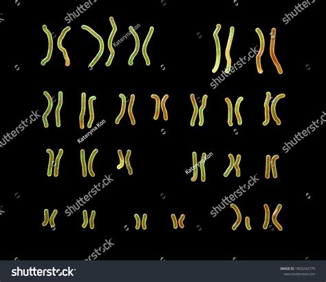 Karyotype Angelman Syndrome 3d Illustration Genetic Stock Illustration