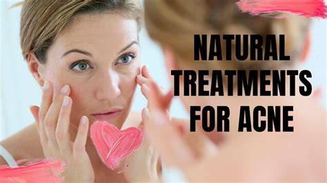 Natural Treatments For Acne Youtube