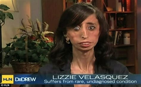 Worlds Ugliest Woman Lizzie Velasquez Gives Courageous Interview