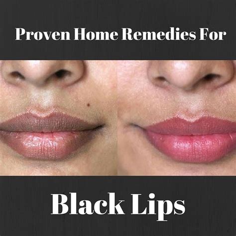 15 natural remedies to treat dark lips at home remedies for dark lips natural pink lips