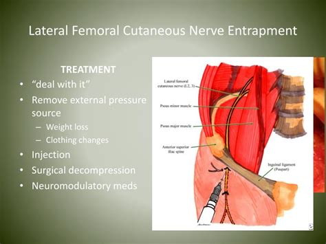 Ppt Nerve Entrapments In Runners Powerpoint Presentation Id4539042