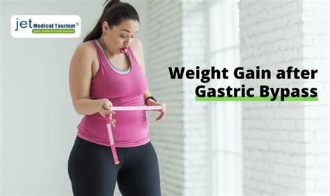 How the gastric sleeve works. How To Restart Weight Loss After Gastric Bypass | Jet ...