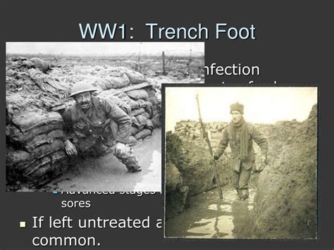 Ppt Conditions Of World War I Powerpoint Presentation Free Download Id2119191