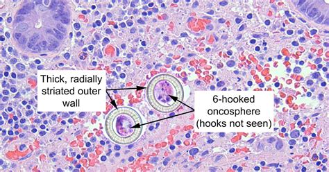 Creepy Dreadful Wonderful Parasites Answer To Case 608