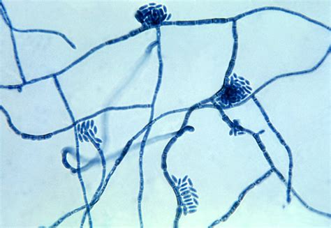 Public Domain Picture This Micrograph Of The Fungus Hortaea Werneckii
