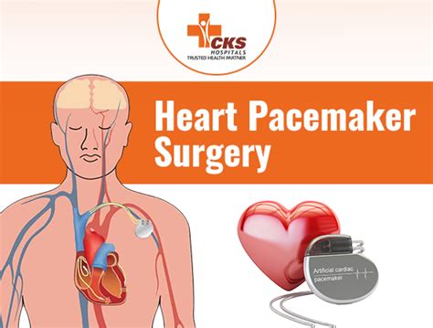 Heart Pacemaker Surgery Procedure