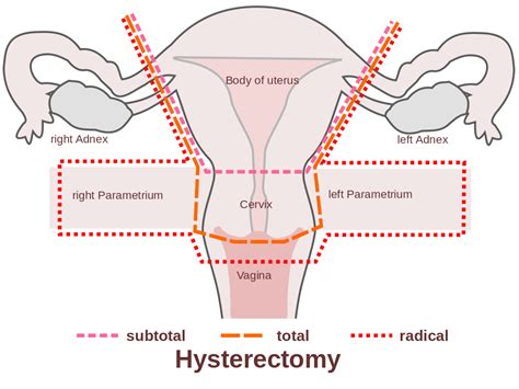 Sex After A Vaginal Hysterectomy Tube Natural Tits