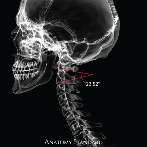 Radiology Imaging Medical Imaging Human Spine Human Body Anatomy
