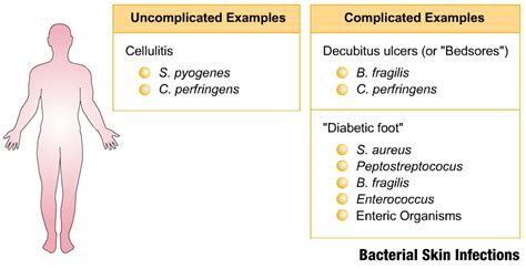 Skin And Soft Tissue Infections Zero Infections