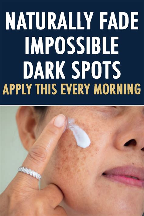 How To Fade Dark Spots Naturally In 2021 How To Fade Skin Care Dark