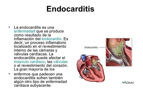 Patologias Del Sistema Circulatorio The Best Porn Website