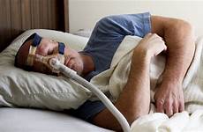 sleep apnea obstructive treatment