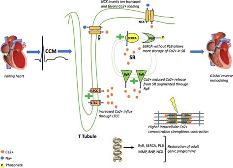 Pathophysiological Mechanisms Of Ccm For Details See The Text Ca2
