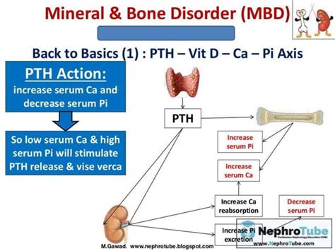 Ckd Mbd Chronic Kidney Disease Mineral Bone Disease Dr Abdel Rahman Mansy