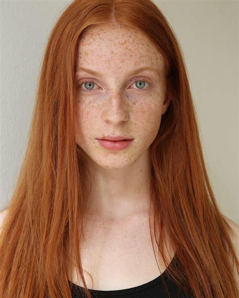 Pin On Freckles Birthmark Beauty Mark Speckle Sommersprossen Pecas