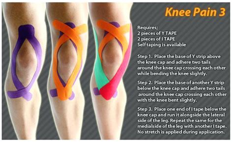 Taping involves sticking strips of elastic use elastic tape and cut the strips to the right length before applying them. The facts of Elastic Colourful Therapeutic Taping, Kinesio ...