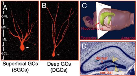 Selective Vulnerability Of Dentate Granule Cells Prior To Amyloid