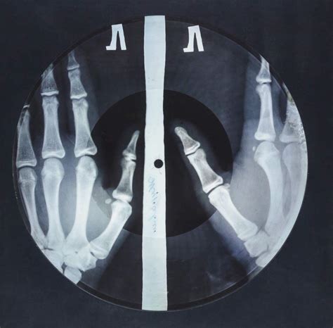 Bone Music The Bootleg X Ray Records Of Soviet Russia The Vale Magazine