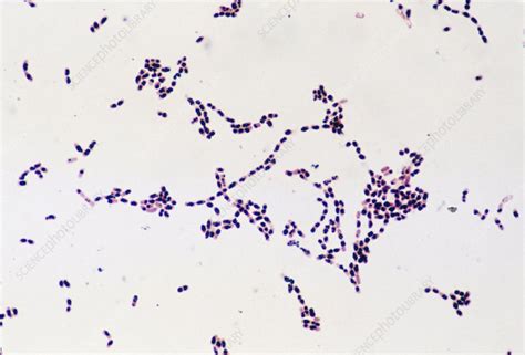 Lm Of Colony Of Bacillus Cereus Bacteria Stock Image B2200204