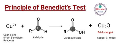Benedicts Test Principle Procedure Steps Results Uses