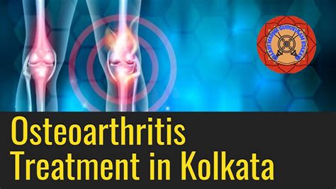 Osteoarthritis Treatment Kolkata Youtube