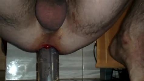 Bleed Ass Anal - Cause For Anal Bleeding Anal Porn Videos | Hot Sex Picture