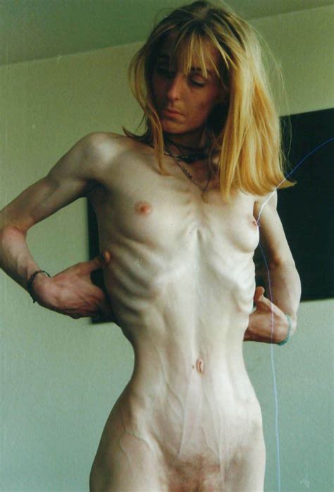 Thin Teen With Anorexia Jerks Best Adult Free Image Telegraph