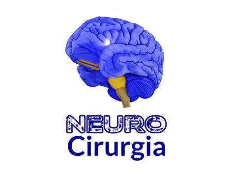 Pin Em Neuro Image Neuroscience Neurology Brain Surgery Neuro