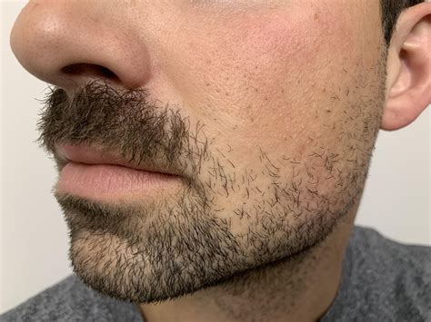 Pin By Mark Lubiarz On Vello Facial Growing A Mustache Growing A