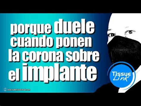 Los Implantes Dentales Si Duelen Pero No Te Lo Dicen Youtube
