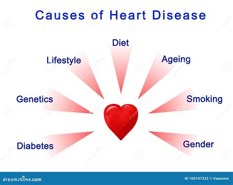 Causes Of Heart Disease Stock Illustration Illustration Of Style