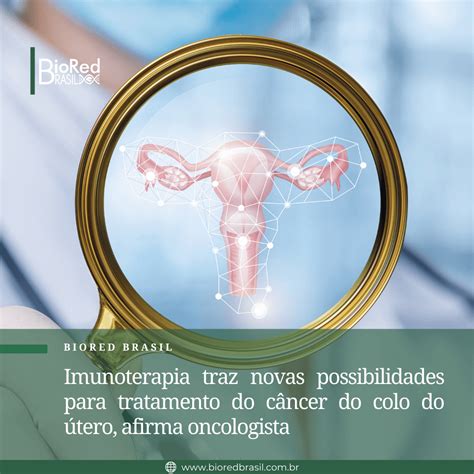 Imunoterapia Traz Novas Possibilidades Para Tratamento Do Câncer Do Colo Do útero Afirma