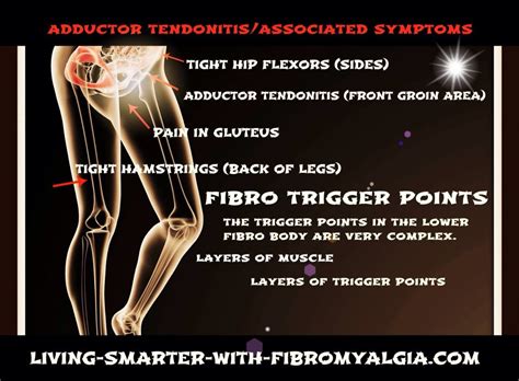 Adductor Tendonitis Tight Hamstrings Fibromyalgia Trigger Points