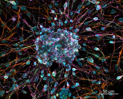 Fuerza Motriz Explosi N Mirar Cuales Son Las Celulas Del Cerebro Humano