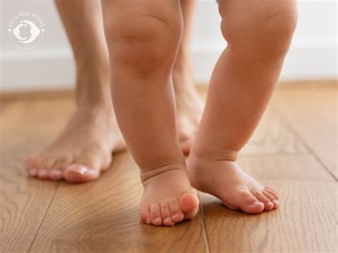 Bowed Legs In Babies Signs Of Bowed Legs When To Visit The Doctor