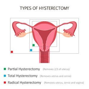 Laparoscopic Ovarian Hysterectomy Surgery Hospital Jalandhar Punjab