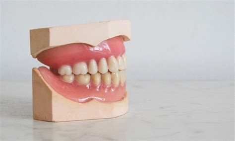 Allt Du Behöver Veta Om Hål I Tanden Aqua Dental