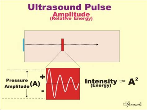 my life: Ultrasound Production and Interactions