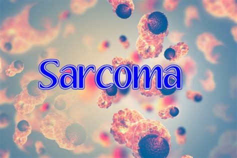 ¿qué Es El Sarcoma De Tejidos Blandos Clinica Hispana Harrisburg