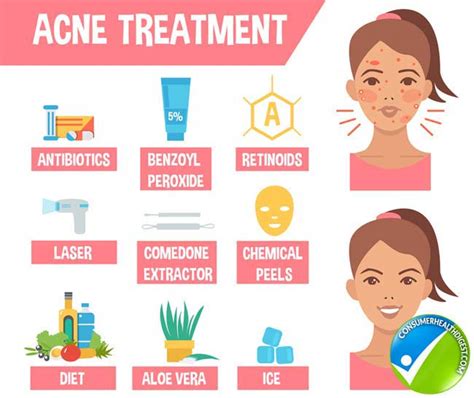 What Is Acne Types Causes Signs Symptoms Treatment