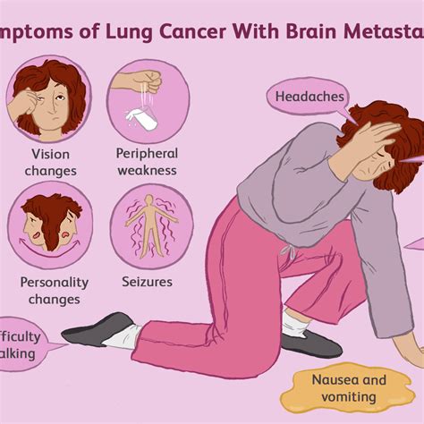 People can be very confused if they read their pathology reports. Lung Cancer Radiation Therapy Success Rate - All About ...