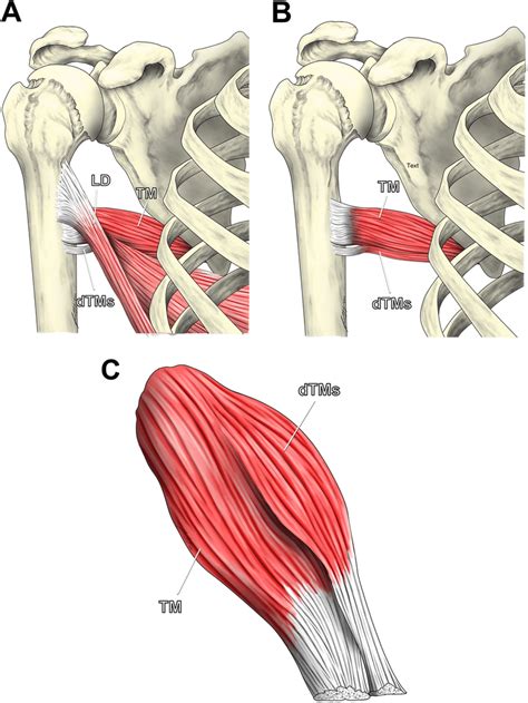 A To C Schematic Drawing Of The Latissimus Dorsi Ld Teres Major Tm