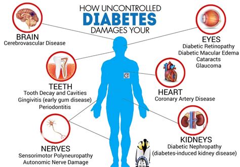 Juvenile Diabetes Possible Complications Gluxus Health Comfortaid
