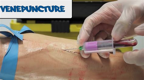 Venepuncture How To Take Blood Osce Guide Youtube