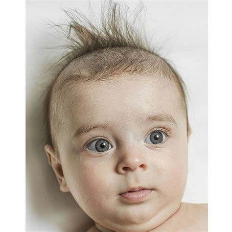 17 Best Pictures Thinning Hair After Baby Style Tips For Thinning