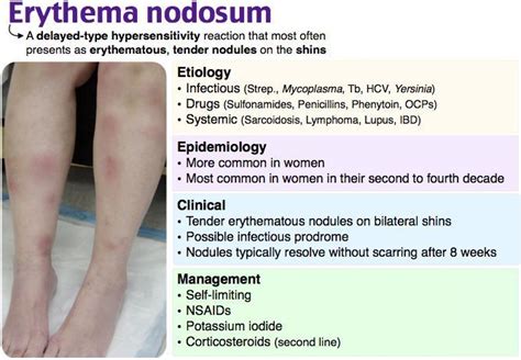 What Type Of Hypersensitivity Reaction Is Erythema Nodosum Derm