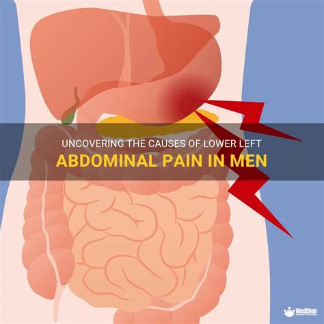 Uncovering The Causes Of Lower Left Abdominal Pain In Men Medshun