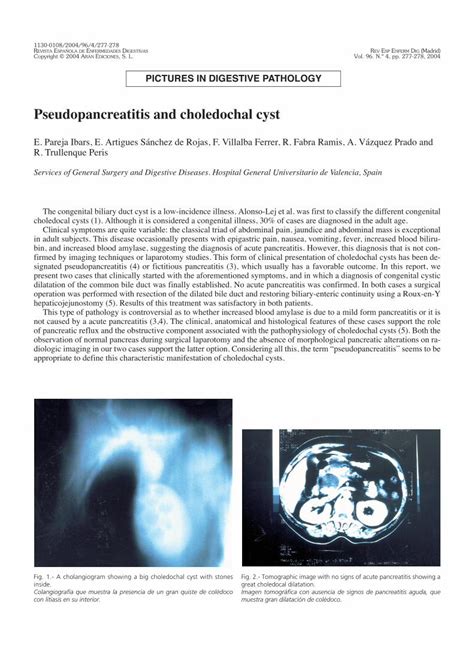 PDF Pseudopancreatitis And Choledochal Cyst Scielo Isciii Esscielo