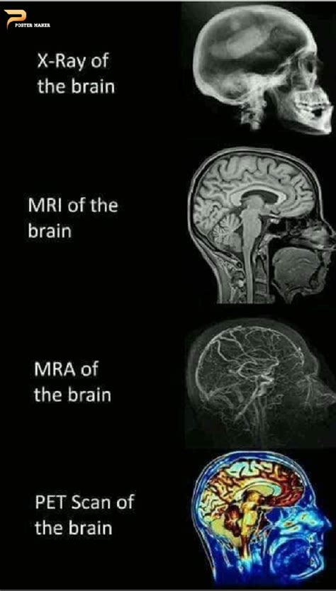 What Are The Differences Between The Types Of Brain Scans Ct Pet Mri